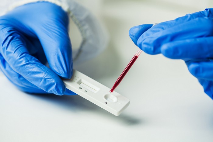 Coronavirus: The reliability of rapid tests questioned by a group of laboratories