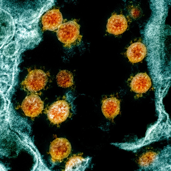 What To Know As New Sars Cov 2 Strains Gain Ground Worldwide We do not know the extent to which this is because of the new variant but no matter its cause we have to take swift and decisive action which unfortunately is absolutely essential to control this deadly disease while the. what to know as new sars cov 2 strains