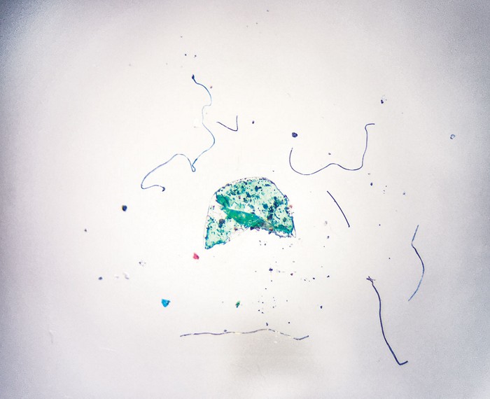 Microscopy image showing blue, gold, and black fibers, a green blob flecked with black, and other multicolored particles.
