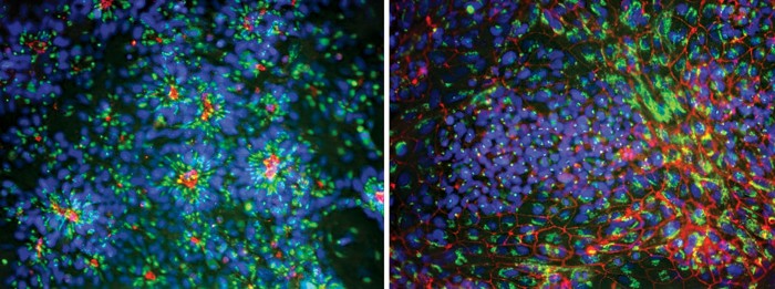 Are developing brains affected by commonly used chemicals?